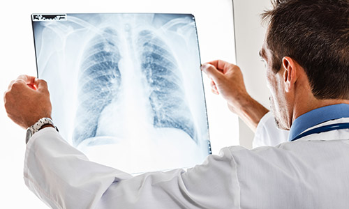 failure-to-diagnose-lawsuit